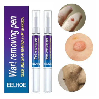 Removal Of Warts Liquid Pen Woman Skin Care Removing Against Moles Patch Remove