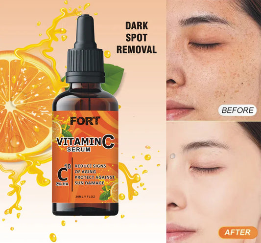 FORT Vitamin C Serum for Face - Anti-Aging, Dark Spot Correcting,